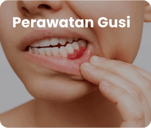 Perawatan Gusi