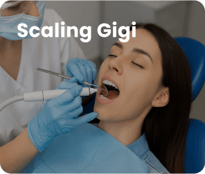 Scaling Gigi