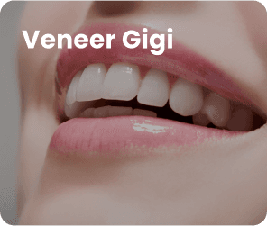 Veneer